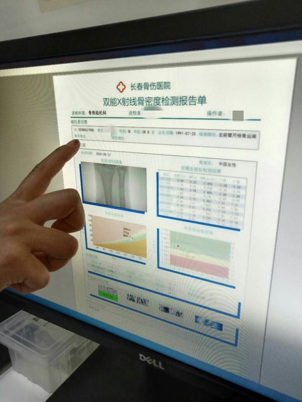 品源雙能X射線骨密度儀落戶吉林省長春骨傷醫(yī)院，助力骨松診療